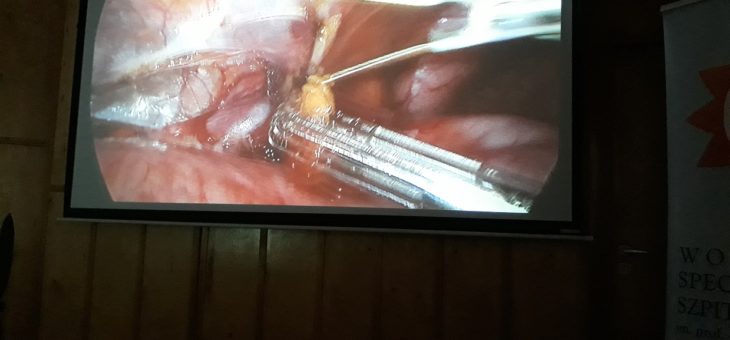 Warsztatami laparoskopowymi rozpoczęła się konferencja chirurgów dziecięcych „Interregio 2018”