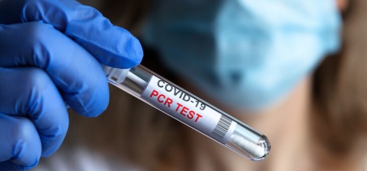 Zapraszamy do skorzystania z naszej oferty diagnostyki w kierunku zakażenia wirusem SARS-CoV-2