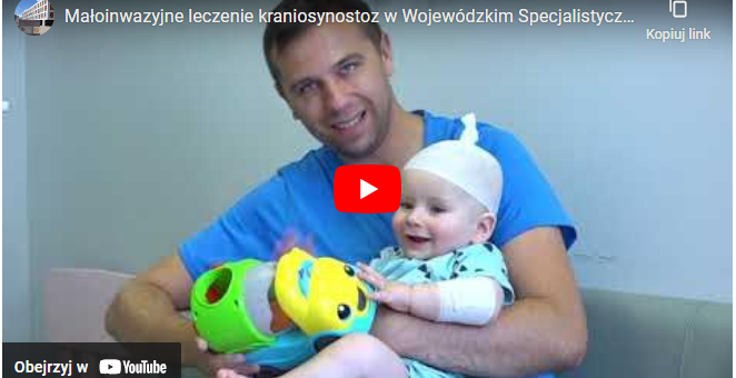 Małoinwazyjne leczenie kraniosynostoz [FILM]