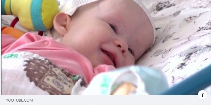 Kompleksowe leczenie kraniosynostoz [FILM]