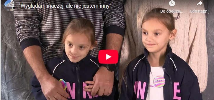 „Wyglądam inaczej, ale nie jestem inny” [FILM]